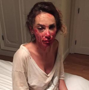 [VIDEO] Rutkowski ratuje „żony Konstancina”.  Ofiara przemocy Ewelina Ślotała zdecydowała się opowiedzieć o swoim dramacie