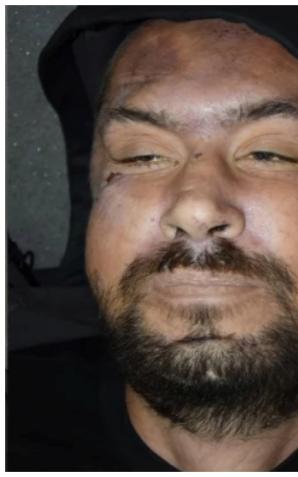 Tajemnicza śmierć w Zgierzu: Policja prosi o pomoc w identyfikacji mężczyzny